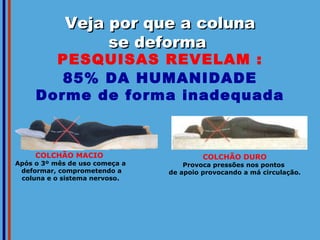 Veja por que a coluna se deforma  PESQUISAS REVELAM : 85% DA HUMANIDADE Dorme de forma inadequada COLCHÃO MACIO   Após o 3º mês de uso começa a deformar, comprometendo a coluna e o sistema nervoso. COLCHÃO DURO Provoca pressões nos pontos  de apoio provocando a má circulação. 