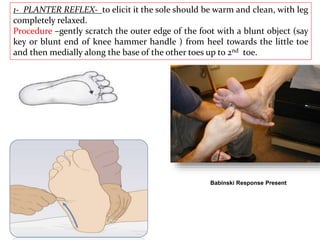 1- PLANTER REFLEX- to elicit it the sole should be warm and clean, with leg
completely relaxed.
Procedure –gently scratch the outer edge of the foot with a blunt object (say
key or blunt end of knee hammer handle ) from heel towards the little toe
and then medially along the base of the other toes up to 2nd toe.
Babinski Response Present
 