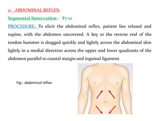 2- ABDOMINAL REFLEX-
Segmental Innervation : T7-12
PROCEDURE- To elicit the abdominal reflex, patient lies relaxed and
supine, with the abdomen uncovered. A key or the reverse end of the
tendon hammer is dragged quickly and lightly across the abdominal skin
lightly in a medial direction across the upper and lower quadrants of the
abdomen parallel to coastal margin and inguinal ligament.
Fig:- abdominal reflex
 