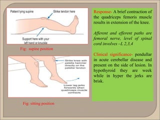 Fig: sitting position
Fig: supine position
Response- A brief contraction of
the quadriceps femoris muscle
results in extension of the knee.
Afferent and efferent paths are
femoral nerve, level of spinal
cord involves –L 2,3,4
Clinical significance- pendullar
in acute cerebellar disease and
present on the side of lesion. In
hypothyroid they are week
while in hyper the jerks are
brisk.
 
