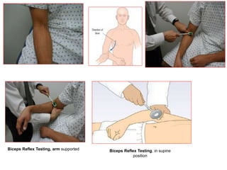 Biceps Reflex Testing, arm supported Biceps Reflex Testing, in supine
position
 