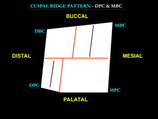 Cuspal Ridges DEMOnstration of carving tooth in waxpy.ppt