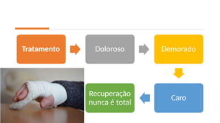 Tratamento Doloroso Demorado
Caro
Recuperação
nunca é total
 