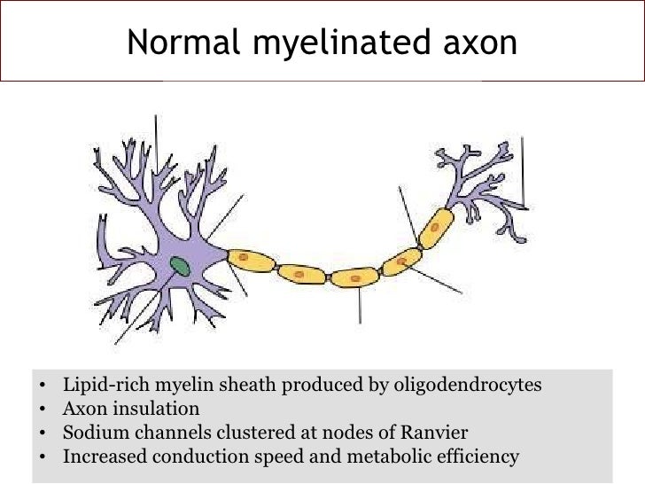 Pathology of Demyelinating Disease