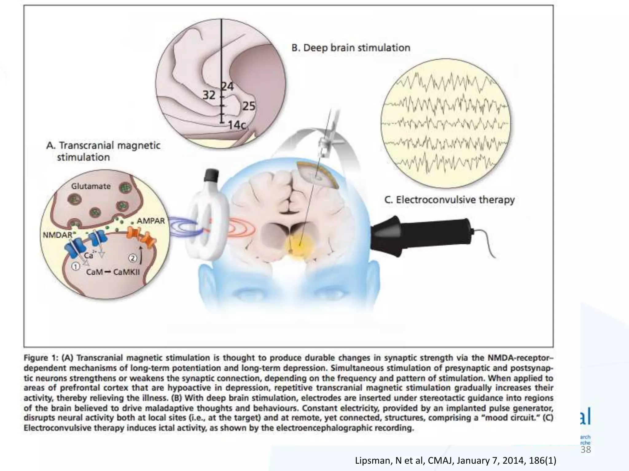 38
Lipsman, N et al, CMAJ, January 7, 2014, 186(1)
 