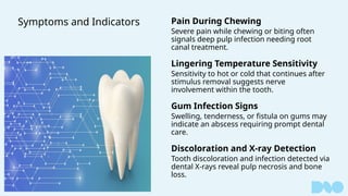Stimulus Tooth Demystifying Root Canal - Saving Your Tooth | PPTX