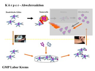 BeladenTumorzelleDendritische Zellen Abwehrzellen
K ö r p e r - Abwehrreaktion
GMP Labor Krems
 