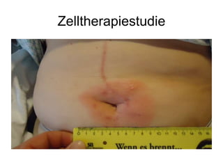 Zelltherapiestudie
 