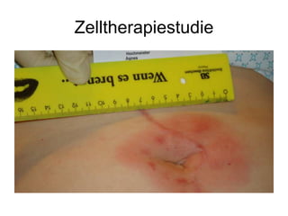 Zelltherapiestudie
 