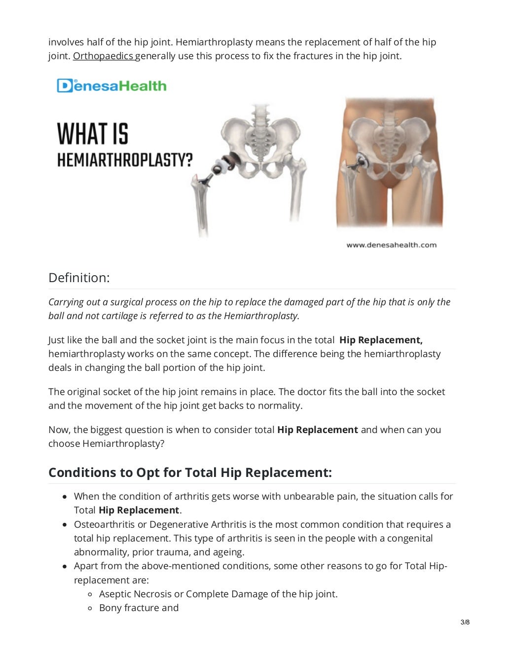 What Is Total Hip Replacement? Difference Between Hemiarthroplasty Vs Total Hip Replacement?