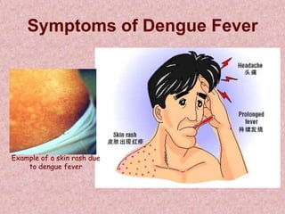 Symptoms of Dengue Fever




Example of a skin rash due
    to dengue fever
 