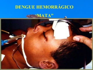 DENGUE HEMORRÁGICO ‘ MATA” 