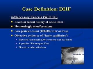 Dengue | PPT