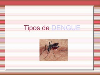 Tipos de  DENGUE 