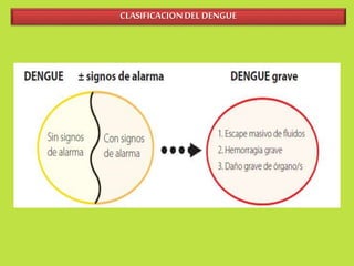 CLASIFICACION DEL DENGUE 
 