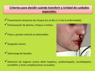  Criterios para decidir cuándo transferir a Unidad de cuidados 
especiales: 
Presentación temprana de choque (en el día 2 o 3 de la enfermedad); 
Extravasación de plasma, choque o ambas; 
Pulso y presión arterial no detectables 
Sangrado masivo 
Sobrecarga de líquidos 
Deterioro de órganos (como daño hepático, cardiomiopatía, encefalopatía, 
encefalitis y otras complicaciones inusuales). 
 