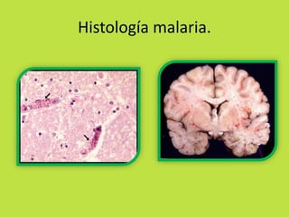 Histología malaria. 
 