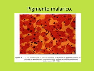 Pigmento malarico. 
 