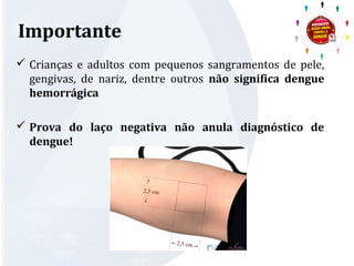 Importante 
 Crianças e adultos com pequenos sangramentos de pele, 
gengivas, de nariz, dentre outros não significa dengue 
hemorrágica 
 Prova do laço negativa não anula diagnóstico de 
dengue! 
 