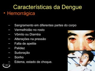 Características da Dengue
• Hemorrágica
– Sangramento em diferentes partes do corpo
– Vermelhidão no rosto
– Vômito ou Diarréia
– Alterações na pressão
– Falta de apetite
– Palidez
– Sudoração
– Sonho
– Edema, estado de choque.
 