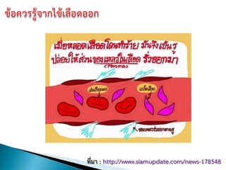 ที่มา : http://www.siamupdate.com/news-178548
 