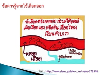 ที่มา : http://www.siamupdate.com/news-178548
 