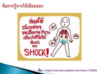 ที่มา : http://www.siamupdate.com/news-178548
 