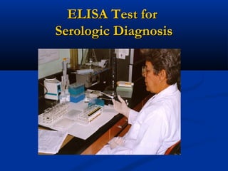 ELISA Test forELISA Test for
Serologic DiagnosisSerologic Diagnosis
 