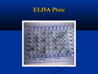 ELISA PlateELISA Plate
 