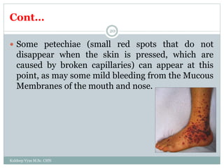 Cont…
Kuldeep Vyas M.Sc. CHN
20
 Some petechiae (small red spots that do not
disappear when the skin is pressed, which are
caused by broken capillaries) can appear at this
point, as may some mild bleeding from the Mucous
Membranes of the mouth and nose.
 