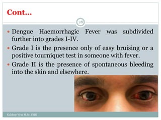 Cont…
Kuldeep Vyas M.Sc. CHN
28
 Dengue Haemorrhagic Fever was subdivided
further into grades I-IV.
 Grade I is the presence only of easy bruising or a
positive tourniquet test in someone with fever.
 Grade II is the presence of spontaneous bleeding
into the skin and elsewhere.
 