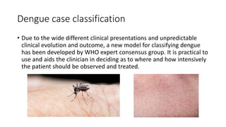 Dengue case classification
• Due to the wide different clinical presentations and unpredictable
clinical evolution and outcome, a new model for classifying dengue
has been developed by WHO expert consensus group. It is practical to
use and aids the clinician in deciding as to where and how intensively
the patient should be observed and treated.
• Due to the wide different
clinical presentations and
unpredictable clinical
evolution and outcome, a
new model for classifying
dengue has been
developed by WHO expert
consensus group. It is
practical to use and aids
the clinician in deciding as
to where and how
intensively the patient
should be observed and
treated.
 
