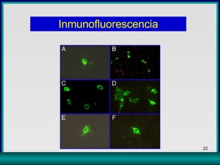 Inmunofluorescencia 