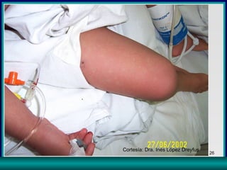 Cortesía: Dra. Inés López Dreyfus 