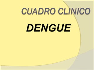 DENGUE
 