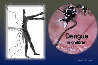 Dengue
in children
- Dr. C.S.N.Vittal
 
