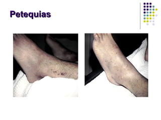PetequiasPetequias
 