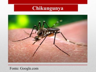 Chikungunya
Fonte: Google.com
 