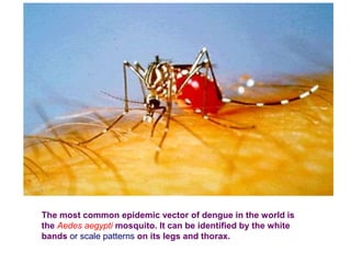 The most common epidemic vector of dengue in the world is
the Aedes aegypti mosquito. It can be identified by the white
bands or scale patterns on its legs and thorax.
 