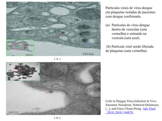 Partículas virais de vírus dengue
em plaquetas isoladas de pacientes
com dengue confirmado.
(a) Partículas do vírus dengue
dentro de vesículas (seta
vermelha) e entrando na
vesícula (seta azul).
(b) Partícula viral sendo liberada
de plaquetas (seta vermelha).
Cells in Dengue Virus Infection In Vivo
Sansanee Noisakran, Nattawat Onlamoon,
[...], and Guey Chuen Perng Adv Virol
. 2010; 2010: 164878.
 