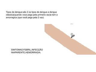Tipos de dengue:são 2 os tipos de dengue a dengue
clássica(quando voce pega pela primeira vez)e tem a
emorragica (que você pega pela 2 vez)
SIMTOMAS:FEBRIL,INFECÇÃO
INAPARENTE,HEMORRAGIA.
 