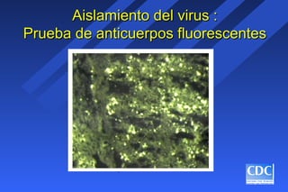 Aislamiento del virus :Aislamiento del virus :
Prueba de anticuerpos fluorescentesPrueba de anticuerpos fluorescentes
 