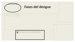 Fases del dengue
 