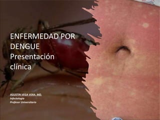 ENFERMEDAD POR
DENGUE
Presentación
clínica
AGUSTIN VEGA VERA. MD.
Infectología
Profesor Universitario
 