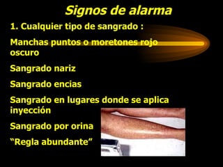 Signos de alarma 1. Cualquier tipo de sangrado : Manchas puntos o moretones rojo oscuro Sangrado nariz Sangrado encias Sangrado en lugares donde se aplica inyección Sangrado por orina “ Regla abundante” 