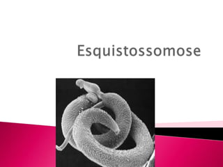 Esquistossomose