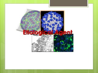 Etiological Agent 