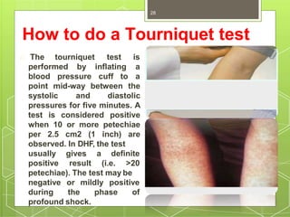 How to do a Tourniquet test
performed by inflating
blood pressure cuff to
The tourniquet test is
a
a
point mid-way between the
systolic and diastolic
pressures for five minutes. A
test is considered positive
when 10 or more petechiae
per 2.5 cm2 (1 inch) are
observed. In DHF, the test
usually
positive
gives a definite
result (i.e. >20
petechiae). The test may be
negative or mildly positive
during the phase of
profound shock.
Dr.T.V.Rao MD
28
 