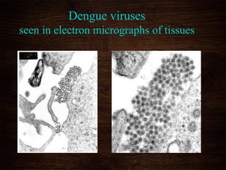 Dengue viruses
seen in electron micrographs of tissues
 