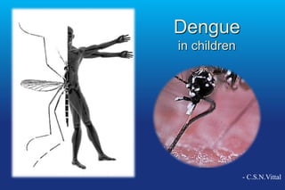 Dengue
in children
- C.S.N.Vittal
 